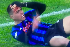 Sao Atalanta đổ máu sau pha va chạm kinh hoàng